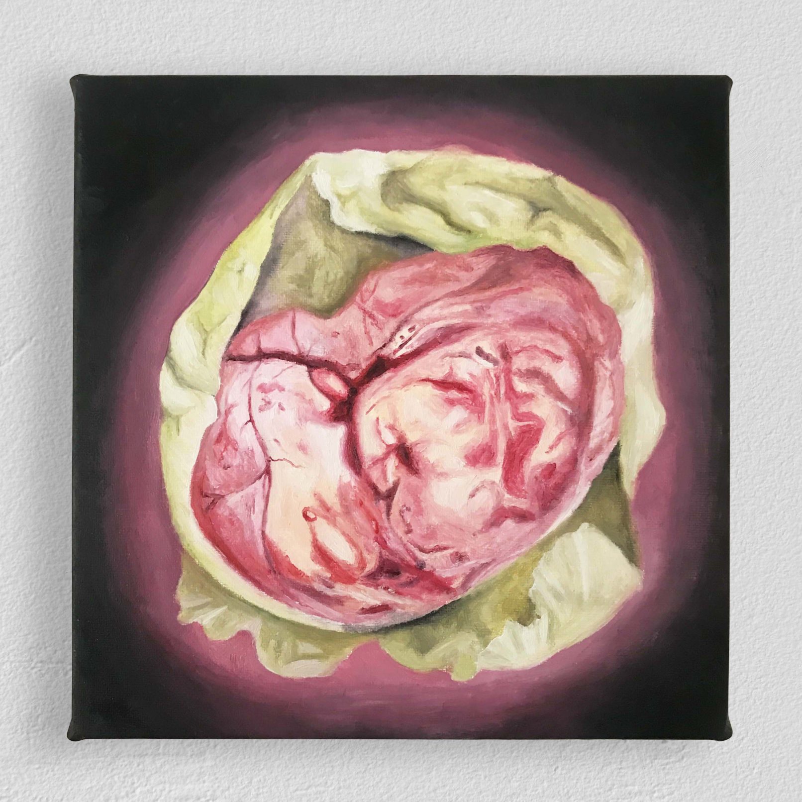 Inside, inre, Uterine Fibroid, Fibromyoma, cabbage, Carine Bovey